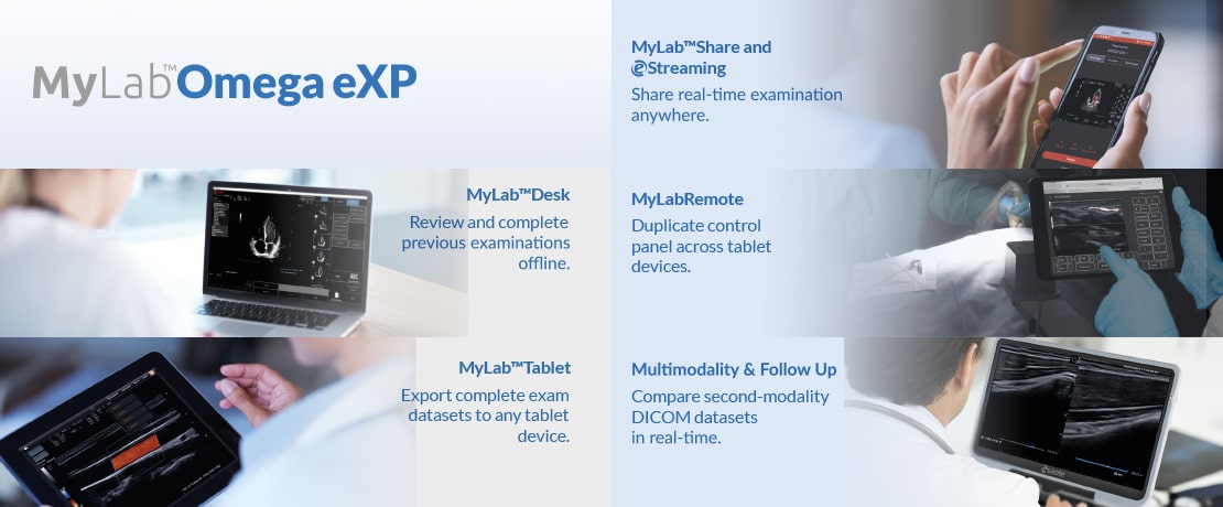 MyLab<sup>™</sup>Omega eXP Flexibility in data management