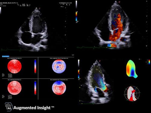 MyLab<sup>™</sup>X90 - Comprehensive offer in cardiovascular and women’s health applications