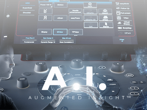 Augmented Insight: Esaote intelligent solutions