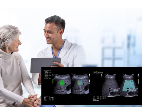 MyLab<sup>™</sup>X90 - Diffuse liver disease assessment