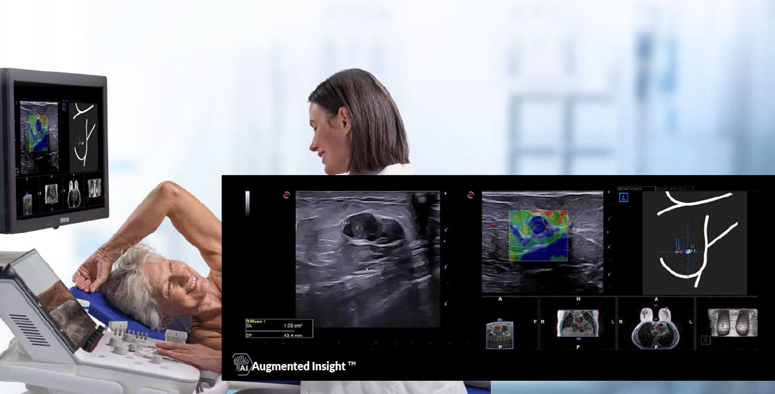 MyLab<sup>™</sup>X90 - Early detection in breast imaging, supported by A.I. solutions