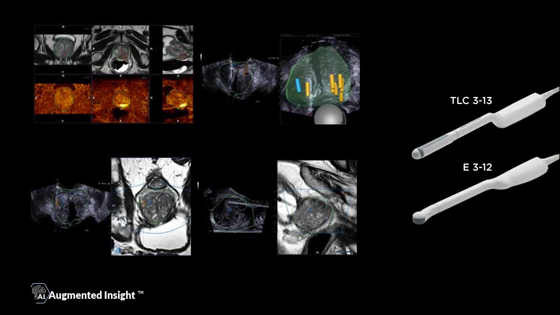 MyLab<sup>™</sup>X90 - New standards in urology supported by A.I. workflow