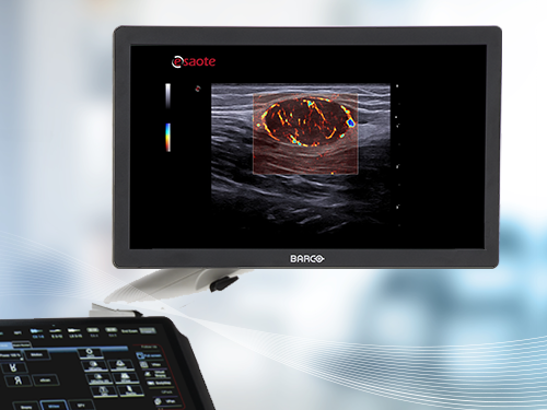 MyLab<sup>™</sup>X90 Top-class medical imaging visualization