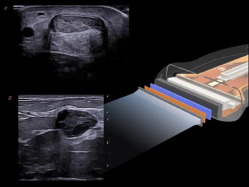 MyLab<sup>™</sup>X90 excellence in very superficial imaging