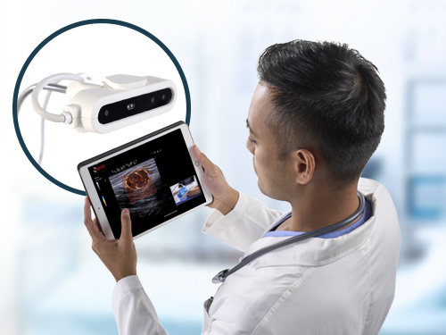 MyLab<sup>™</sup>X90 real-time streaming of ultrasound