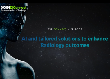 AI and tailored solutions to enhance Radiology outcomes