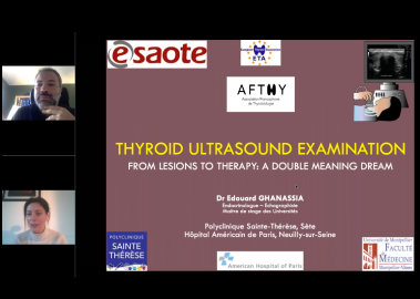 Thyroid Ultrasound Examination - Lesions and Therapy