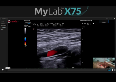 Best practices in ultrasound carotids examination