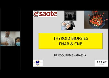 Thyroid nodules biopsies: from the fine-needle aspiration to the core-needle - Why and How