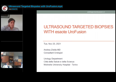 Ultrasound Targeted Biopsies with UroFusion