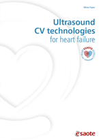 Ultrasound CV technologies for heart failure