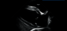Clinical Image - MyLab™EightVET Cardio - B-Mode