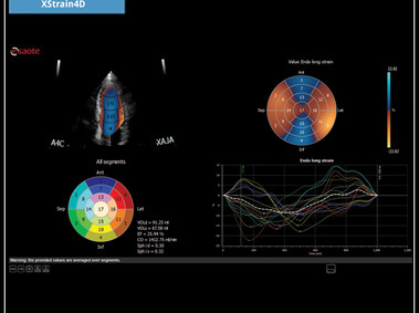 Clinical Image - MyLab<sup>™</sup>X7: XStrain4D