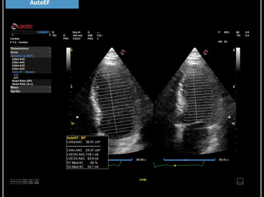 Клиническое изображение - MyLab<sup>™</sup>X7: технология AutoEF