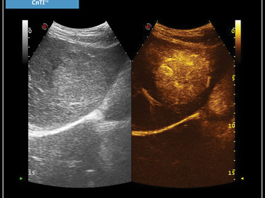 Clinical Image - MyLab<sup>™</sup>X7: CnTI<sup>™</sup>