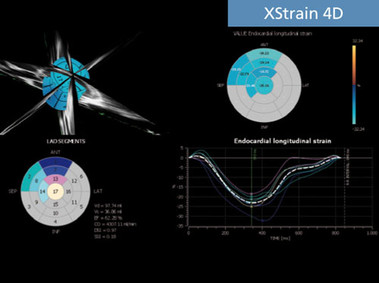 Клиническое изображение – MyLab<sup>™</sup>Seven – (технология XStrain<sup>™</sup>4D)
