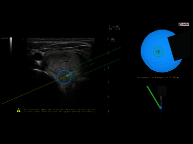 Clinical Image - MyLab<sup>™</sup>Eight eXP - Neck Virtual Biopsy