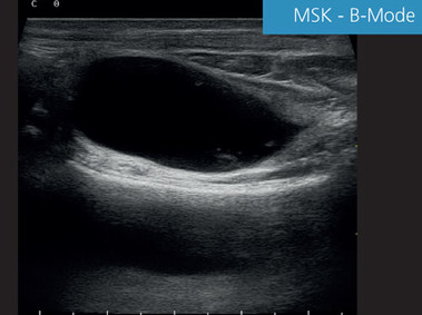 Clinical Image - MyLab<sup>™</sup>EightVET - MSK B-Mode