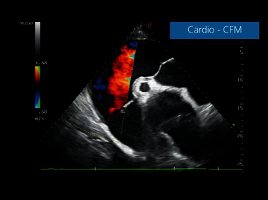 Clinical Image - MyLab<sup>™</sup>EightVET - Cardio CFM