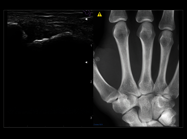 MyLab<sup>™</sup>Sigma Elite - Clinical Image - Follow Up in real-time with a second modality (not available in all countries)