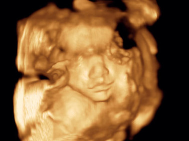 Klinisches Bild – MyLab<sup>™</sup>Gamma – Säuglingsgesicht (X4D-Bildgebung)
