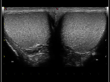 Clinical Image - MyLab<sup>™</sup>9 Platform - High resolution imaging in testis