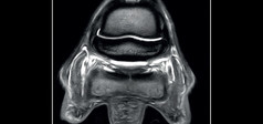 Clinical Image - G-scan equine: Pastern