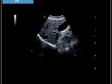 Clinical Image - MyLab<sup>™</sup>X7: CPI