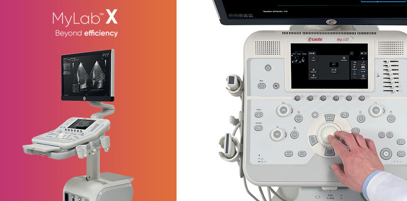 MyLab<sup>™</sup>X7 Ultrasound Imaging Beyond Efficiency