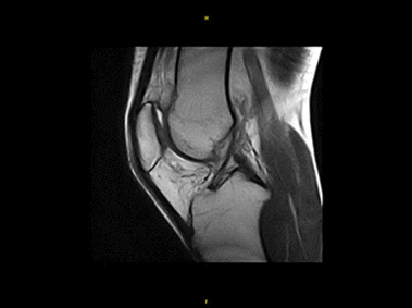 O-scan - Knee Streaming