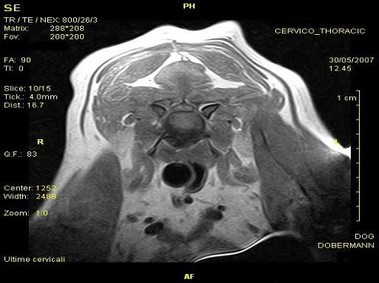 Imagen clínica - Vet-MR - Cervicotorácica - SE dorsal ponderada en T1