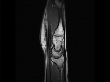 O-scan - Wrist - SE T1 Sagittal