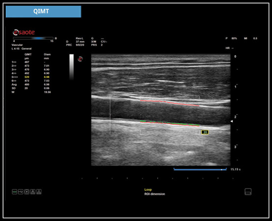 Клиническое изображение - MyLab™X6: технология QIMT