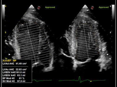 Clinical Image - MyLab<sup>™</sup>Omega - Zero-Click AutoEF