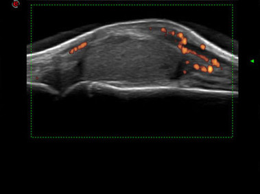 Clinical Image - MyLab<sup>™</sup>Twice - Finger