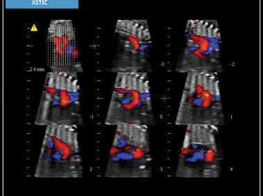 Clinical Image - MyLab<sup>™</sup>X7: XSTIC