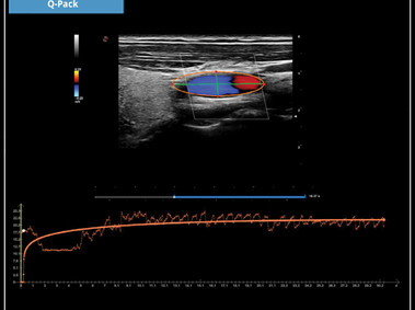 Clinical Image - MyLab<sup>™</sup>X7: Q-Pack