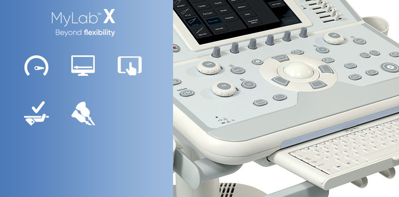 MyLab<sup>™</sup>X6 Ultrasound imaging beyond flexibility