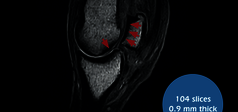Clinical Image - O-scan equine: Fetlock Arthropathy