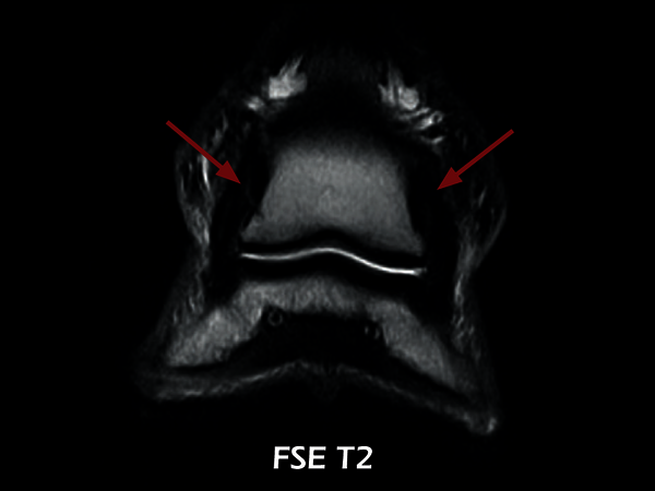 Clinical Image - O-scan equine: Lesion of the collateral ligaments of the coffin joint