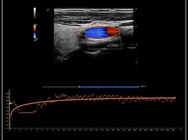 Clinical Image - MyLab<sup>™</sup>9 Platform - QPack quantification capabilities on-board even with CFM