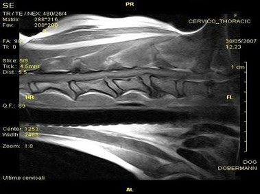Imagen clínica - Vet-MR - Cervicotorácica - SE dorsal ponderada en T1