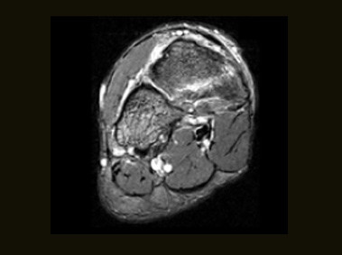 S-scan - Ankle GE Axial