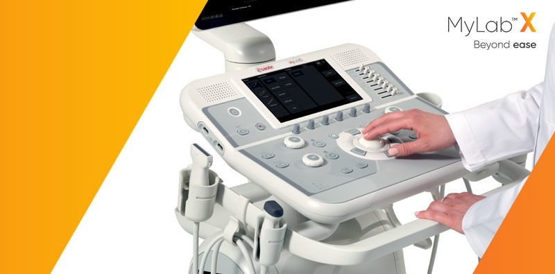 MyLab<sup>™</sup>X5 Ultrasound Imaging Beyond Ease