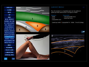 MyLab<sup>™</sup>Sigma Elite - Clinical Image - MyLibrary on board reference guide (not available in all countries)