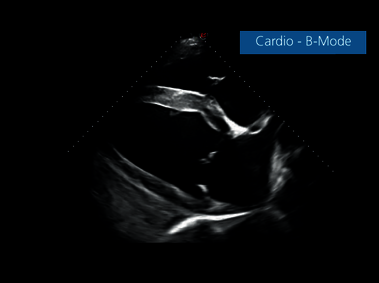Clinical Image - MyLab<sup>™</sup>EightVET Cardio - B-Mode