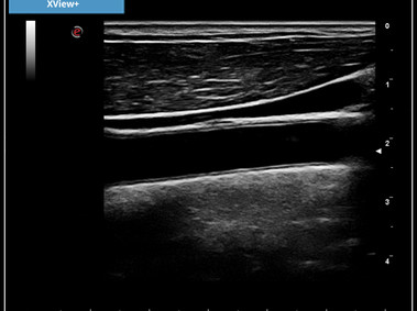 Clinical Image - MyLab<sup>™</sup>X7: XView+