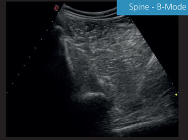 Immagine Clinica - MyLab<sup>™</sup>EightVET - Colonna vertebrale B-Mode