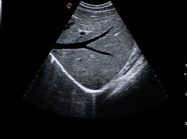 Clinical Image - MyLab<sup>™</sup>Gamma - Abdominal overview