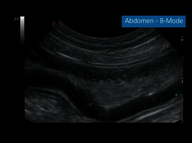 Clinical Image - MyLab<sup>™</sup>EightVET Abdomen - B-Mode